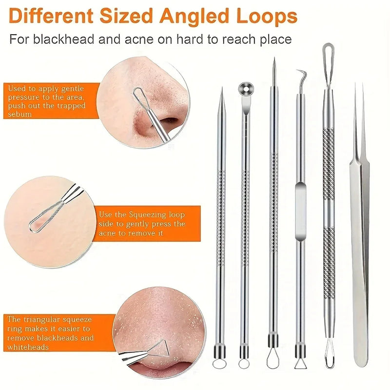 Conjunto de Pinças de Espinhas Ultra-Precisas – 6 Peças